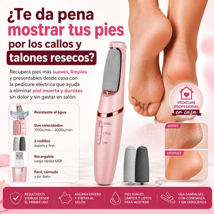Limador Eléctrico de Callos LimaPed™ | BellaVitta